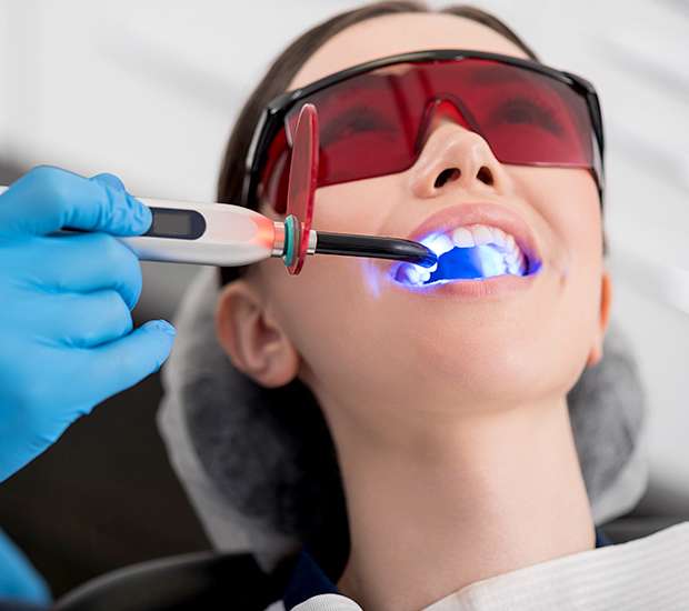 Manassas Professional Teeth Whitening